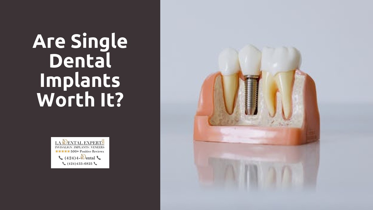 Are single dental implants worth it?