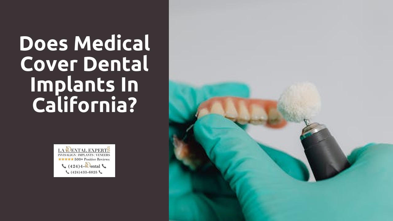 Does medical cover dental implants in California?