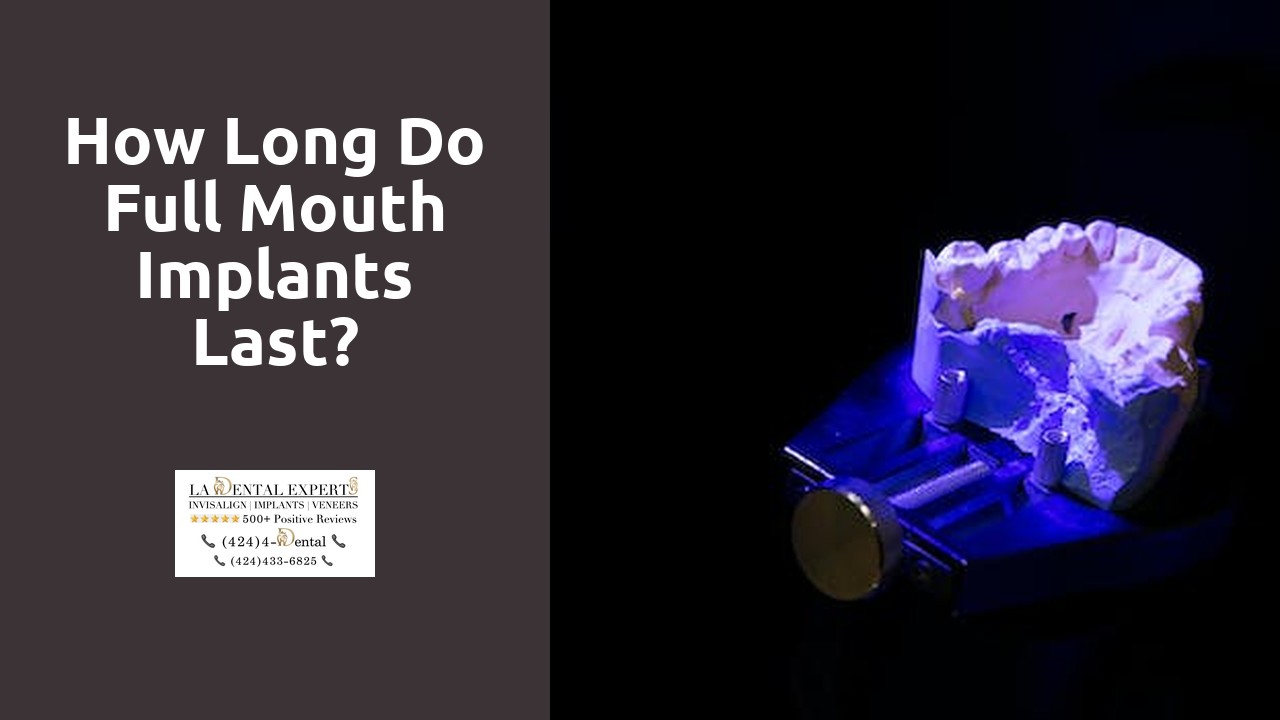 How long do full mouth implants last?