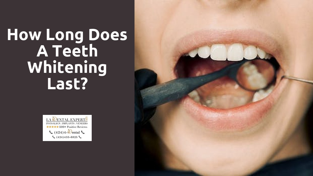 How long does a teeth whitening last?