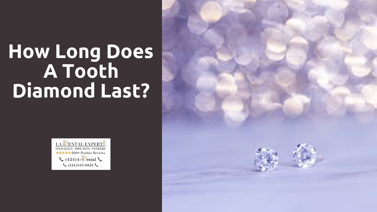 How long does a tooth diamond last?