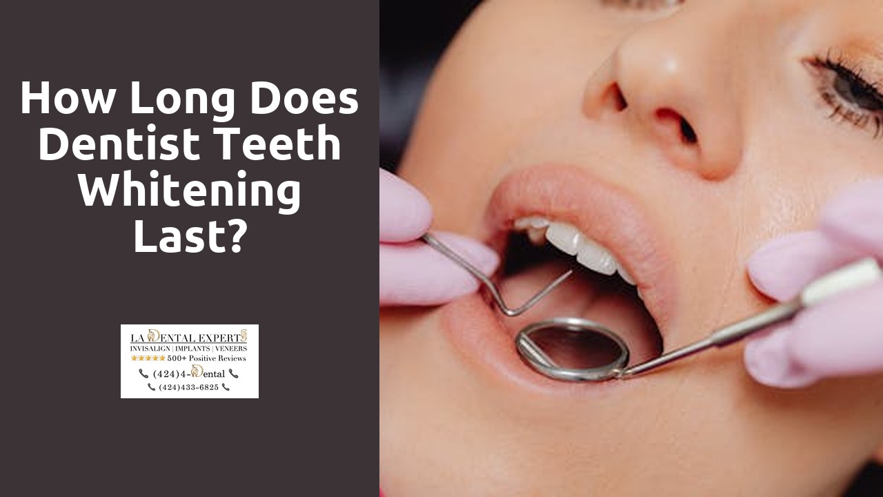 How long does dentist teeth whitening last?