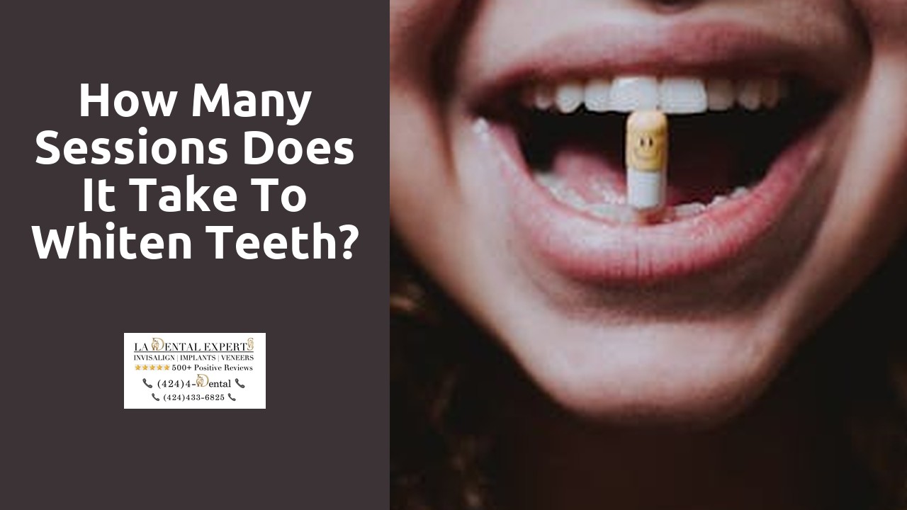How many sessions does it take to whiten teeth?