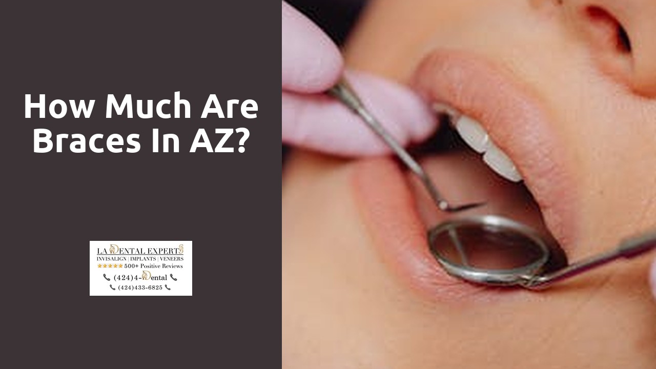 How much are braces in AZ?