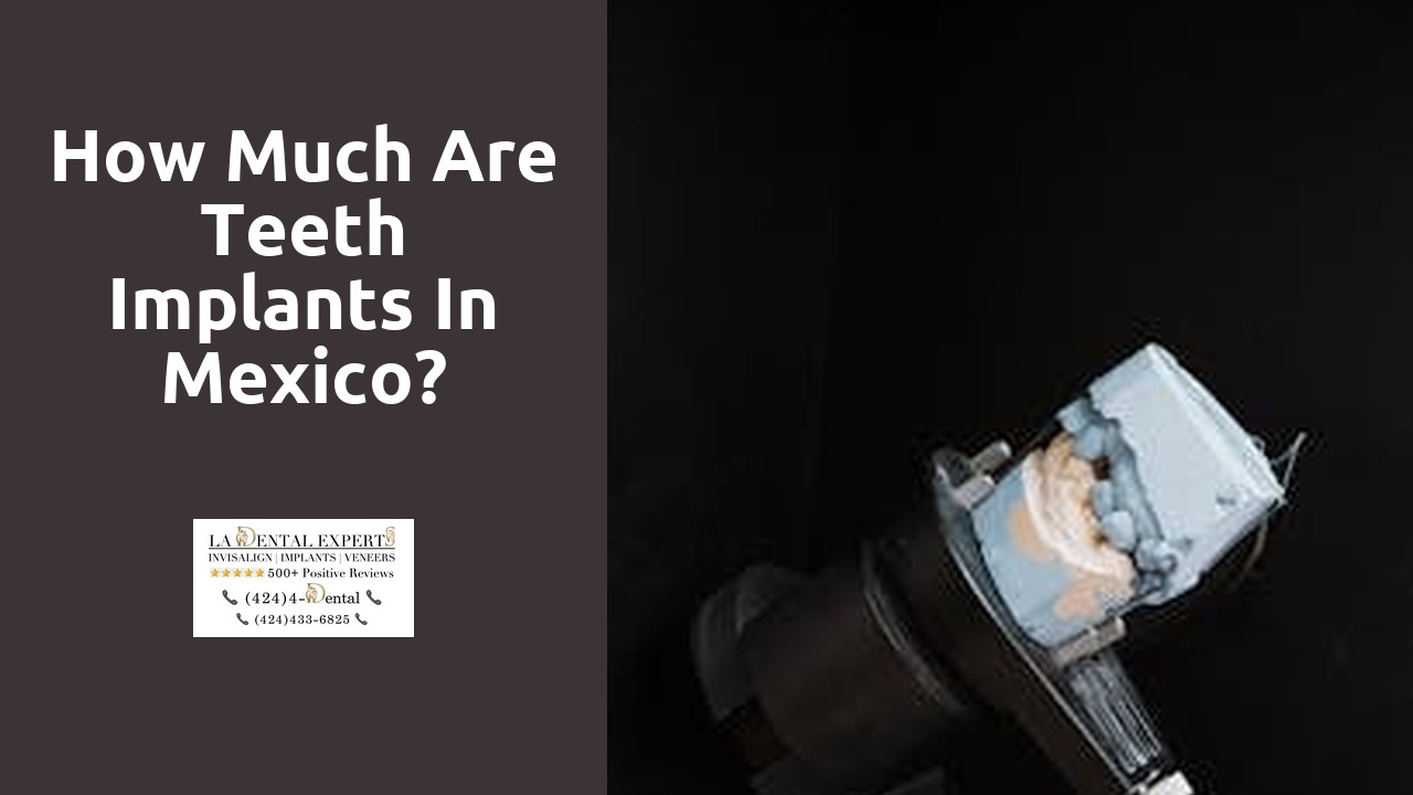 How much are teeth implants in Mexico?