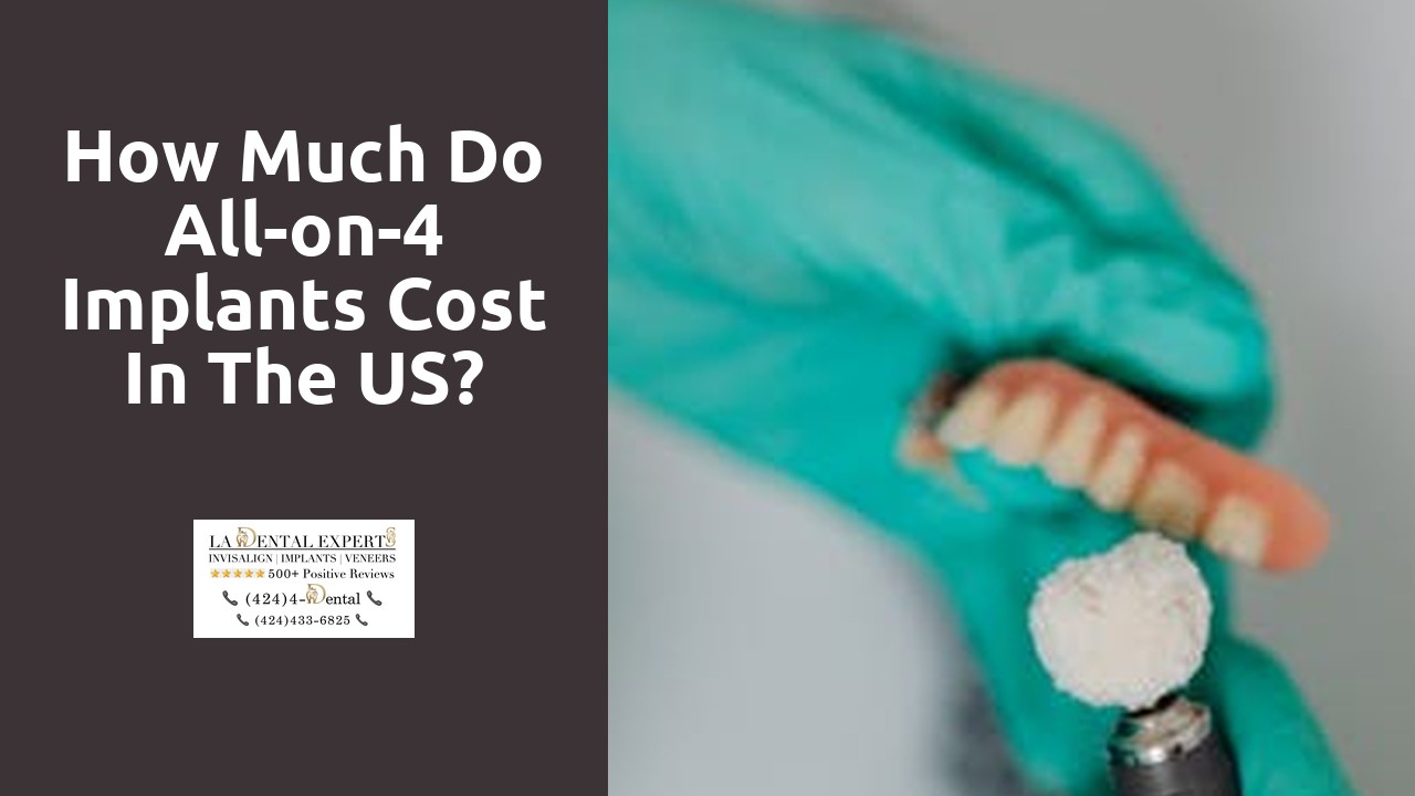 How much do All-on-4 implants cost in the US?