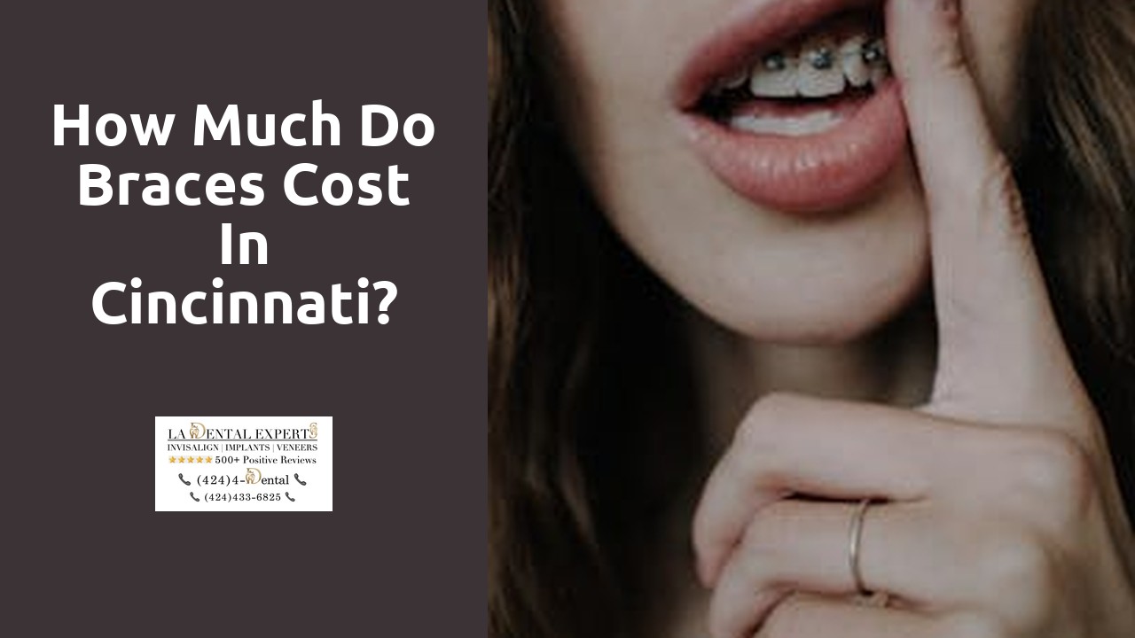 How much do braces cost in Cincinnati?