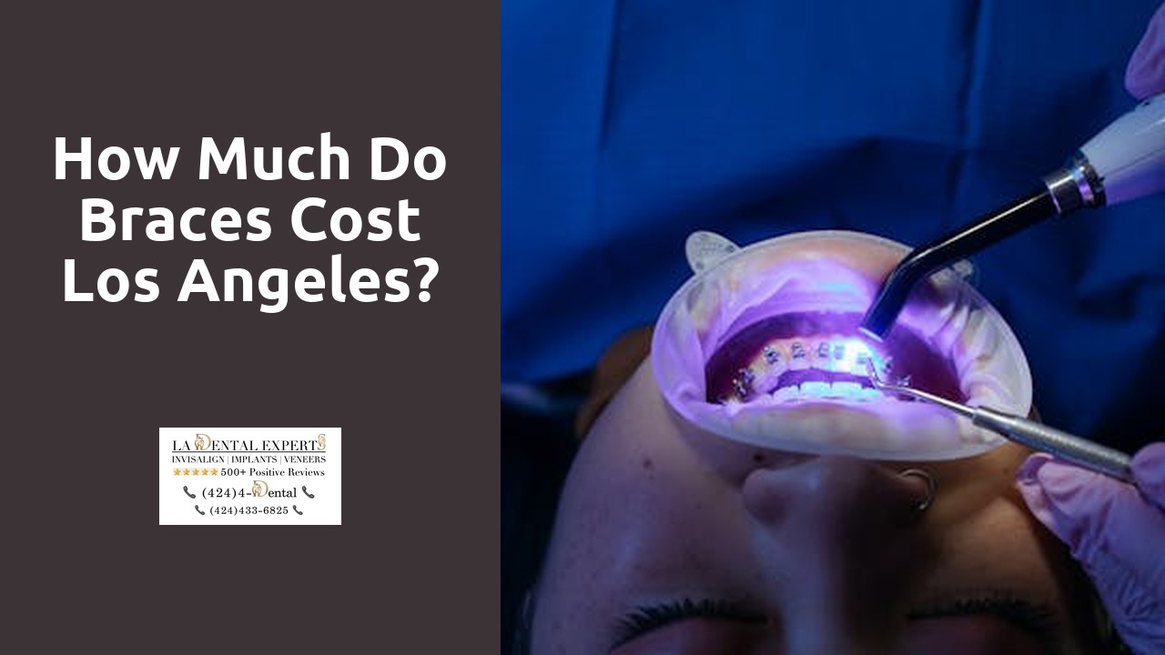 How much do braces cost Los Angeles?