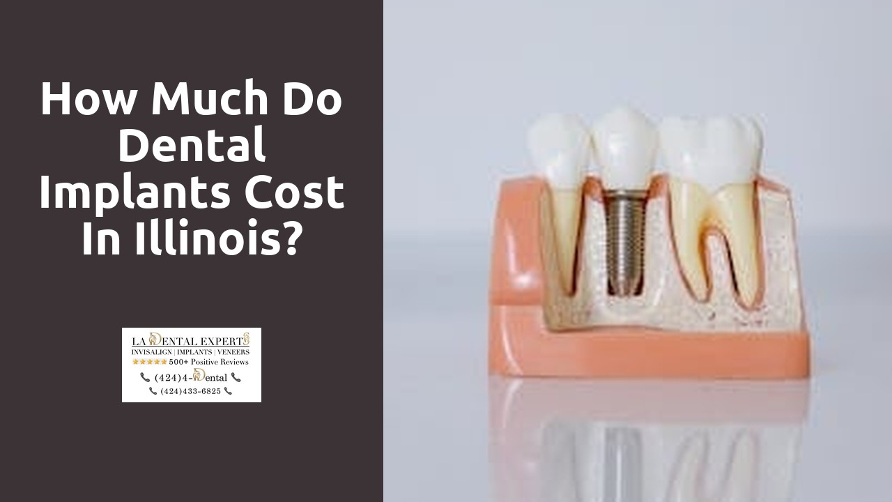 How much do dental implants cost in Illinois?