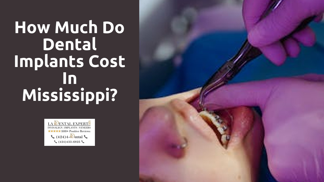 How much do dental implants cost in Mississippi?