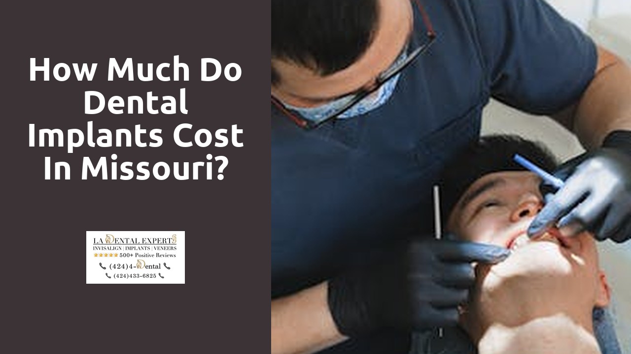 How much do dental implants cost in Missouri?