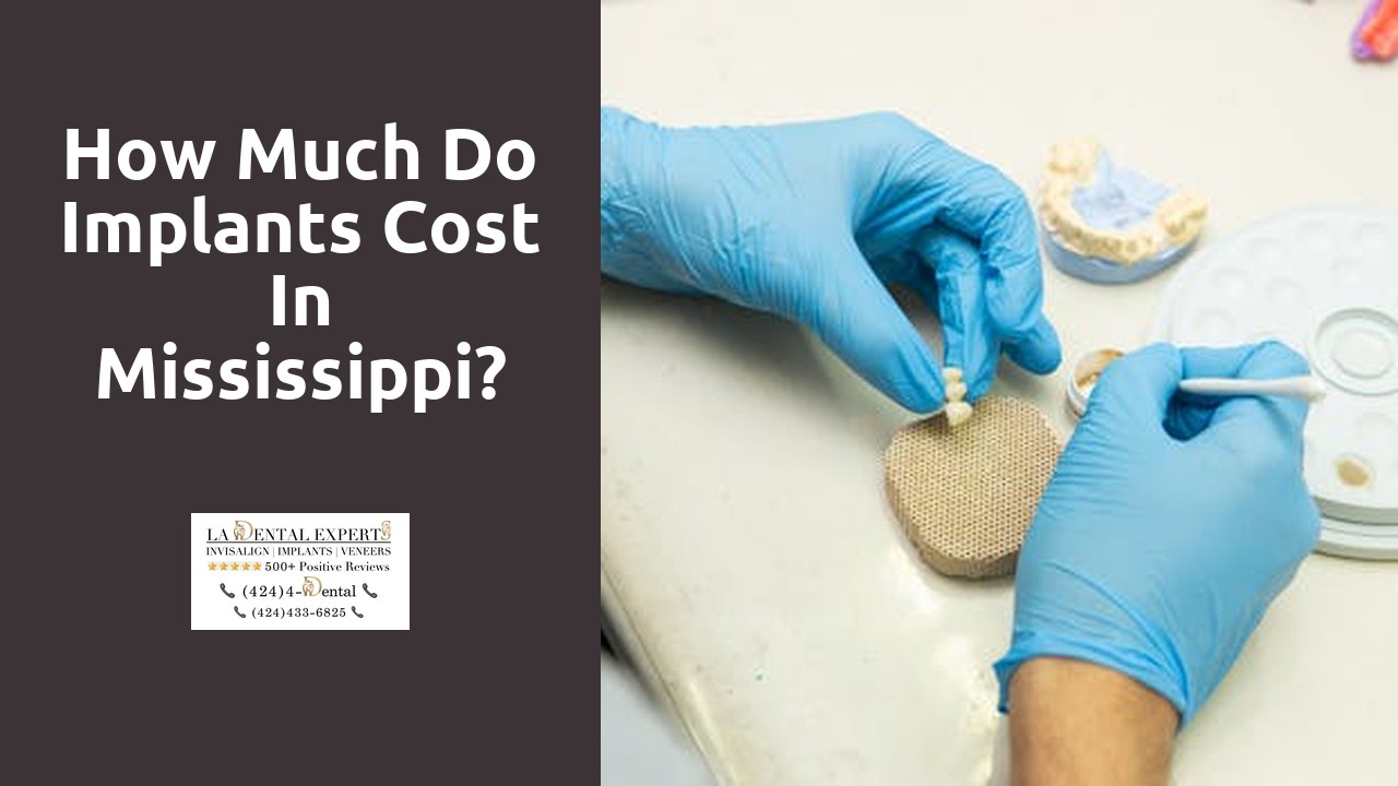 How much do implants cost in Mississippi?