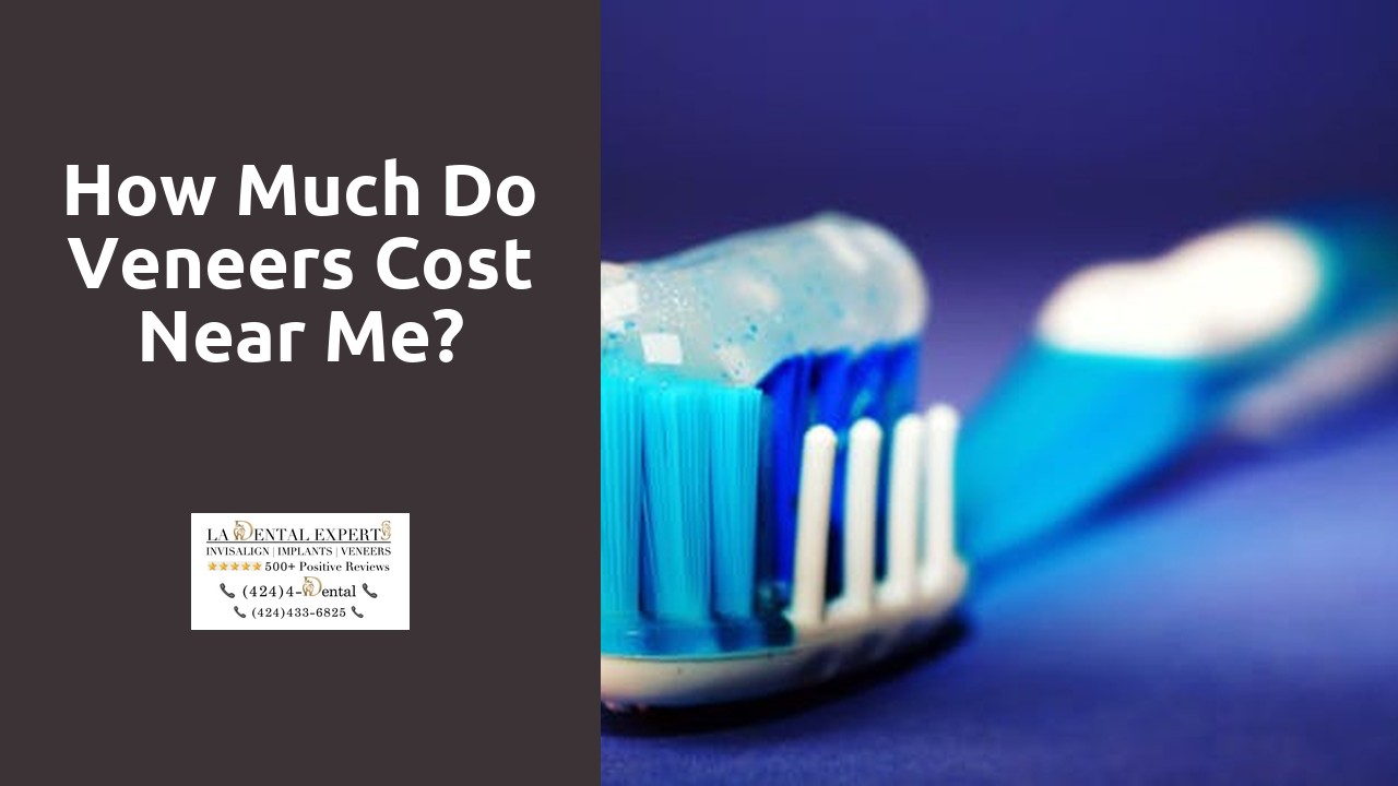 How much do veneers cost near me?