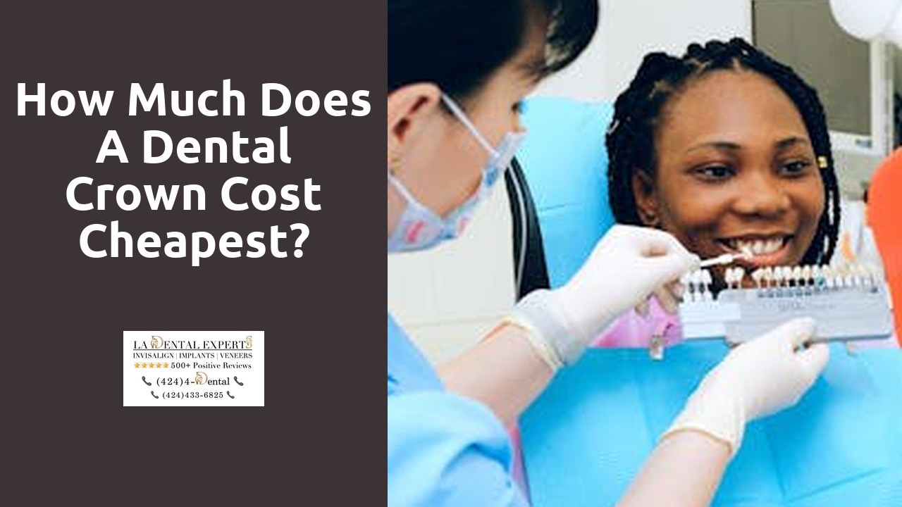 How much does a dental crown cost cheapest?