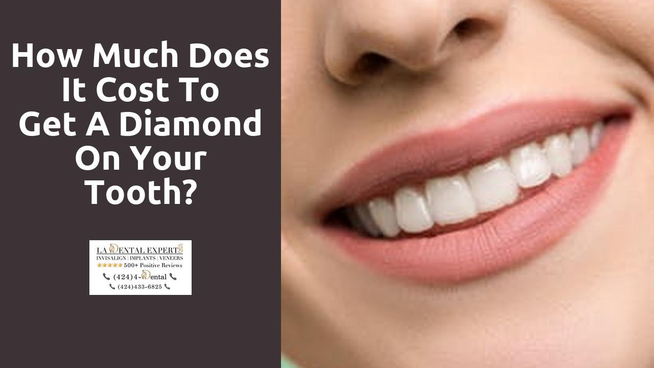How much does it cost to get a diamond on your tooth?