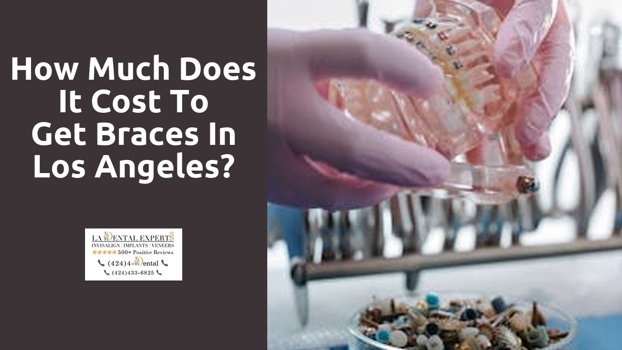 How much does it cost to get braces in Los Angeles?