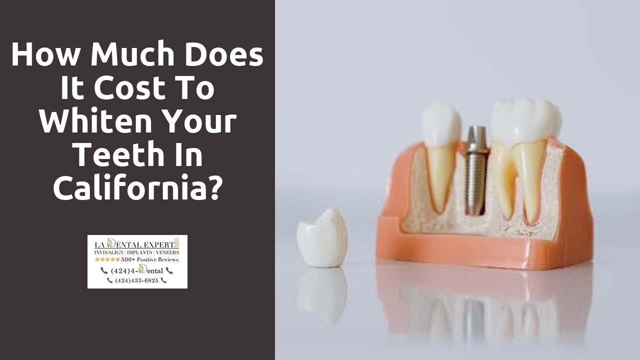 How much does it cost to whiten your teeth in California?