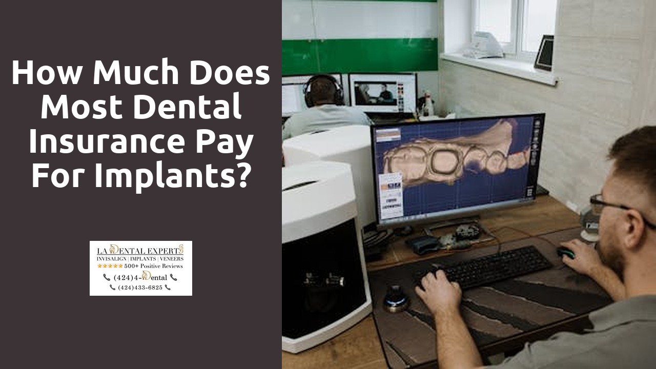 How much does most dental insurance pay for implants?