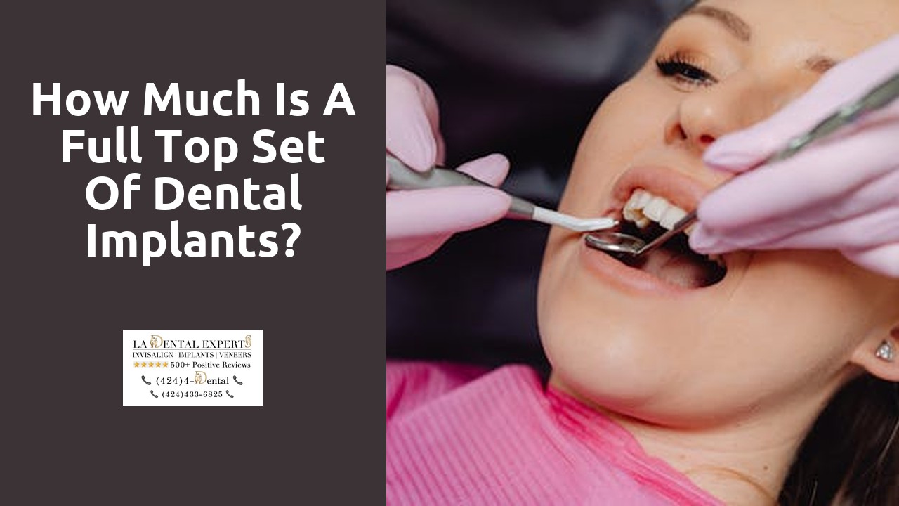 How much is a full top set of dental implants?