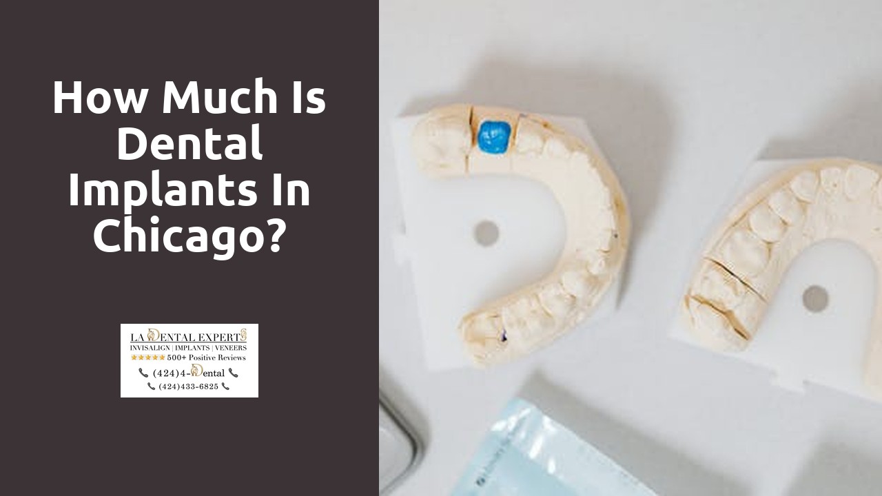 How much is dental implants in Chicago?