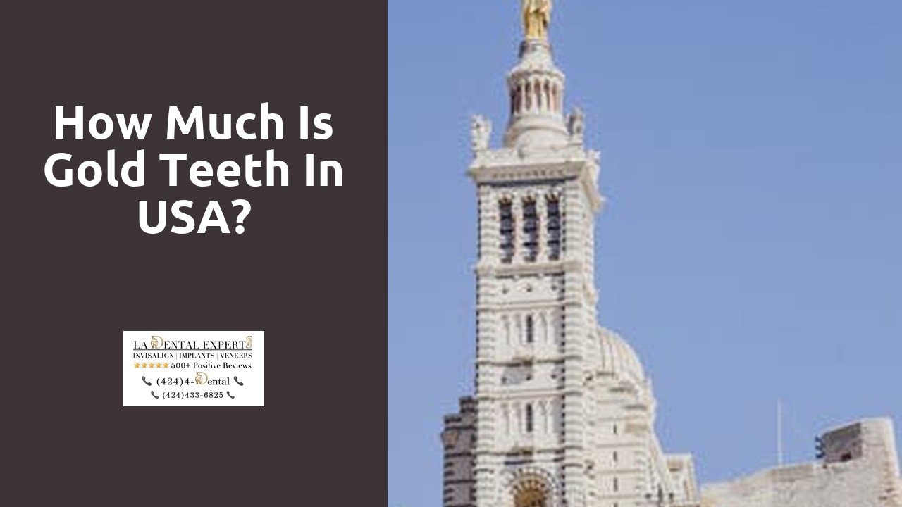 How much is gold teeth in USA?