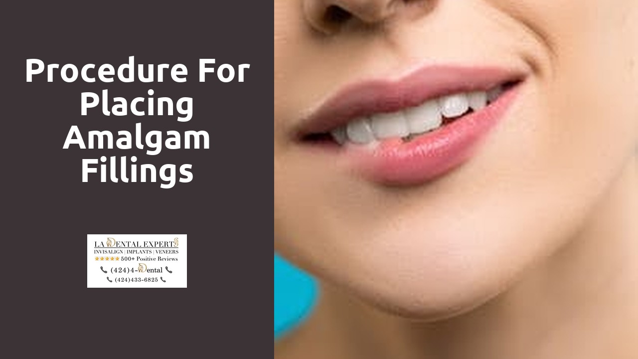 Procedure for Placing Amalgam Fillings