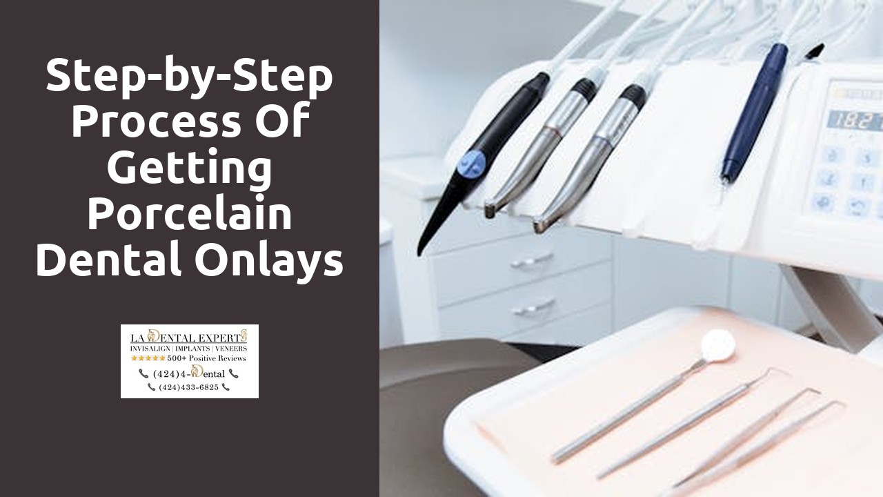 Step-by-Step Process of Getting Porcelain Dental Onlays