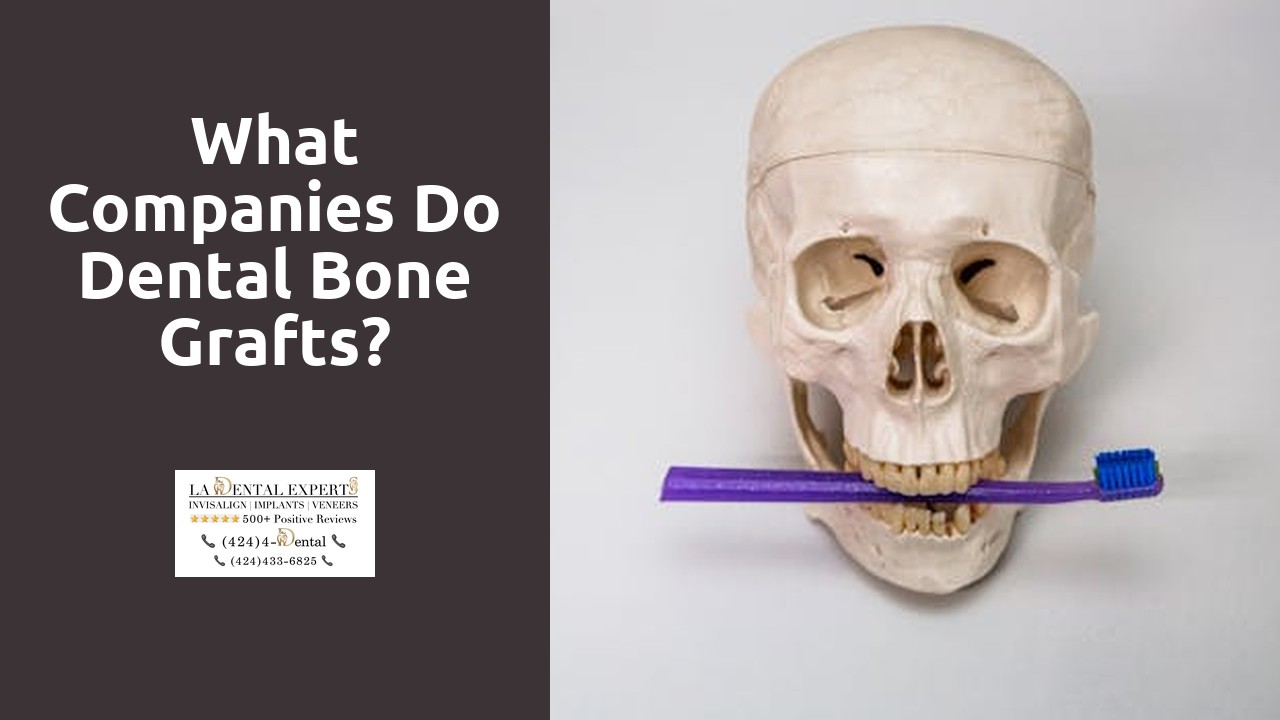 What companies do dental bone grafts?