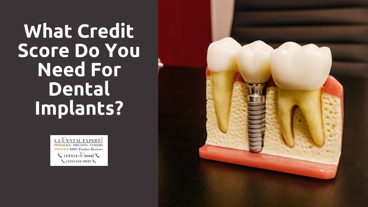What credit score do you need for dental implants?