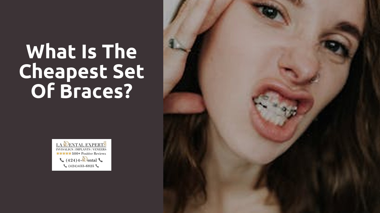 What is the cheapest set of braces?