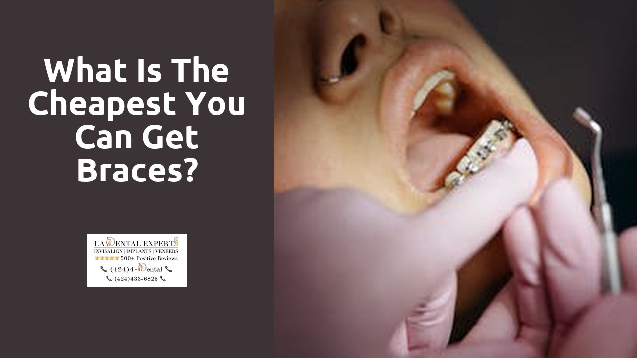 What is the cheapest you can get braces?