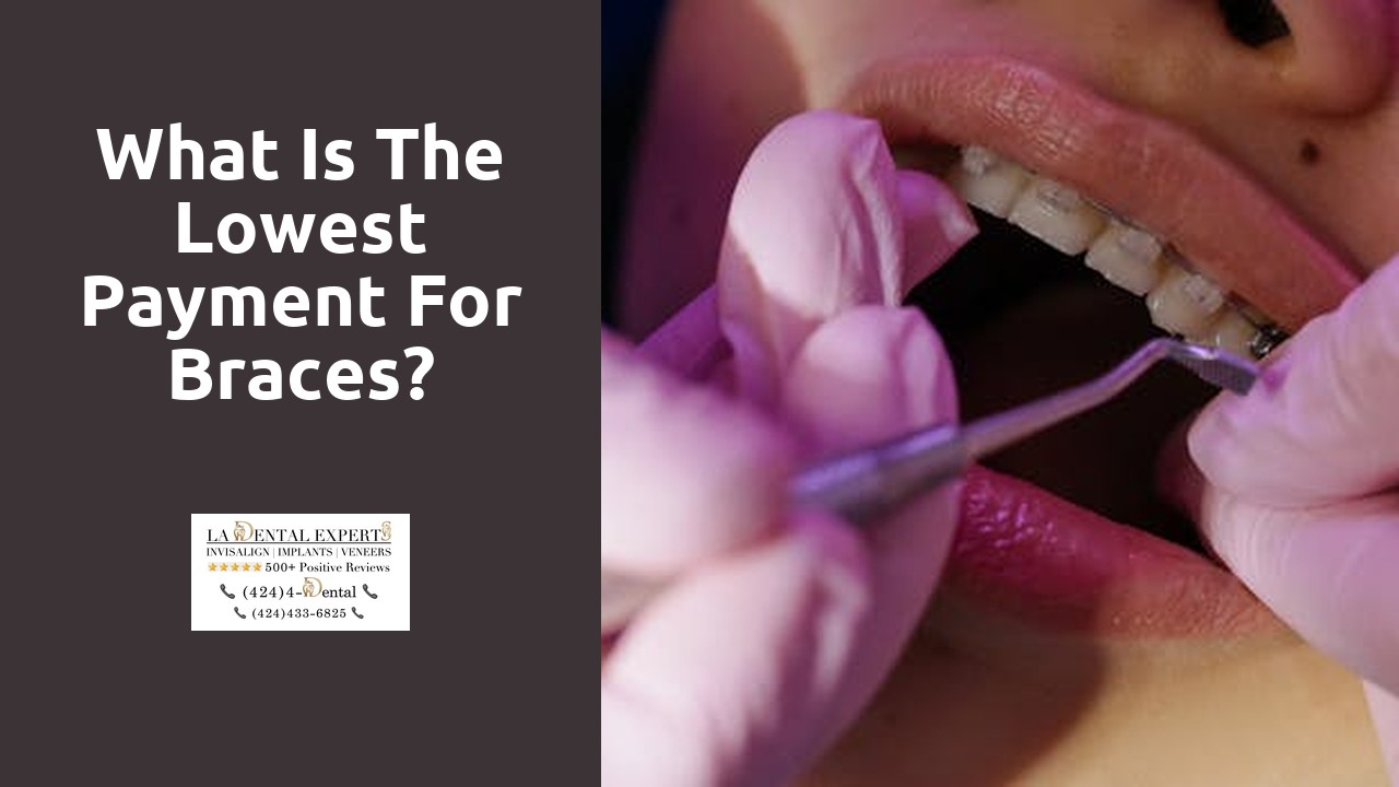 What is the lowest payment for braces?